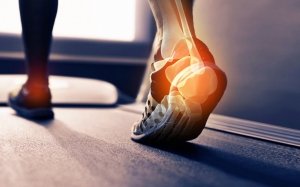 heel pain from running