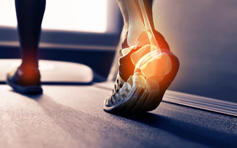 Running on Toes: Should You Run on Toes, Heels, or Midfoot?
