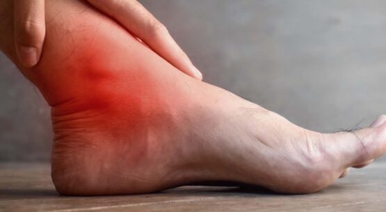 Heel Pain Specialist | Expert Podiatrist and Heel Pain Treatment Bursitis and Nerve Entrapments