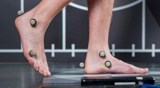 Custom Orthotics Sydney | Personalised Podiatry at Our Clinic - Gait Problems