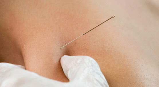 manual therapy & dry needling sports podiatrist sydney {{brizy_dc_image_alt imageSrc=