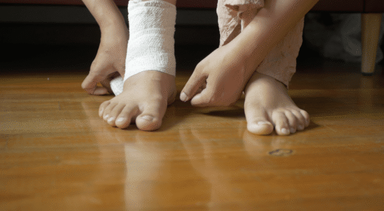 severs disease (children) gait analysis sydney