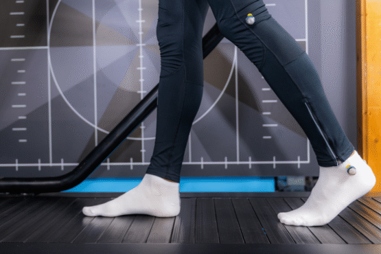 sydneys advanced gait analysis experts gait analysis sydney