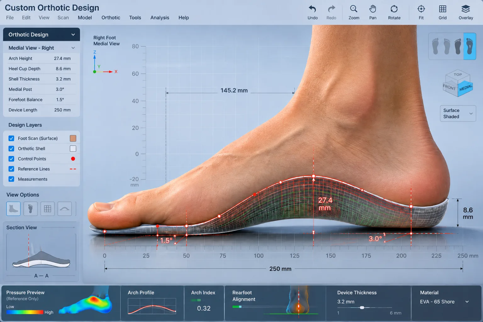 CAD modelling of custom orthotics