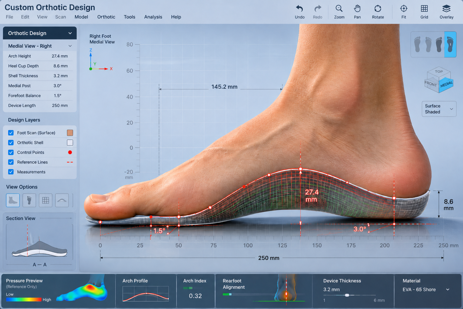 CAD modelling of custom orthotics