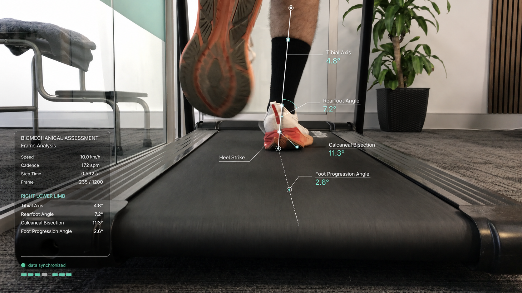 Biomechanical functional assessment