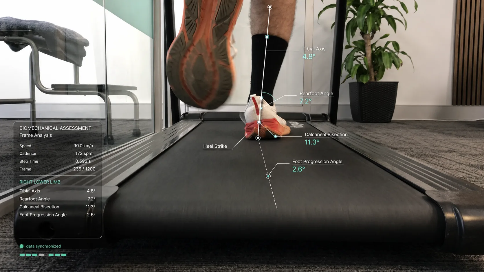 Biomechanical functional assessment